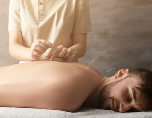 Bisakah Akupunktur Melawan Kanker?