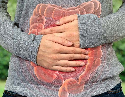 Faktor Penyebab Risiko Kanker Usus Besar