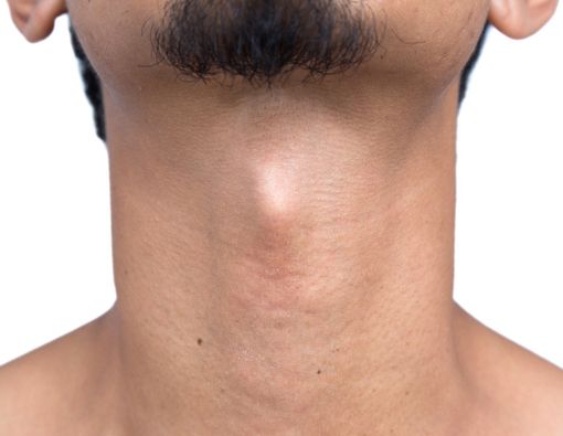 Mengapa Pria Tumbuh Jakun?