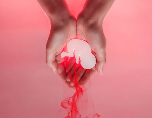 Aborsi Spontan, Apa Maksud dan Penyebabnya?