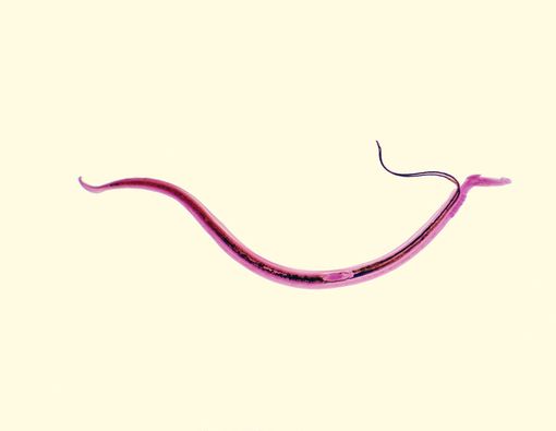 Mengenal Schistosomiasis, Infeksi Cacing yang Mematikan