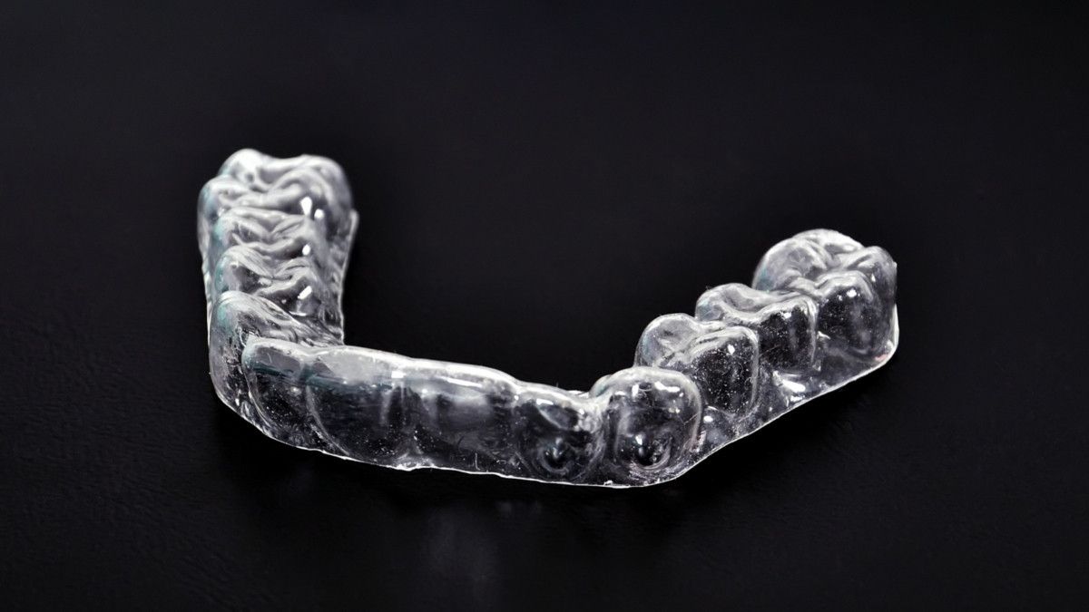 Mengenal Dental Splinting, Perawatan untuk Gigi yang Goyang