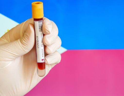 Kasus COVID-19 di Kota Cebu Capai 5.500, Lockdown Diperpanjang