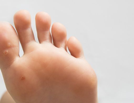 Mata Ikan Muncul Pada Bayi, Ini Faktanya!