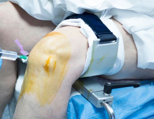 Mengenal Tugas Dokter Spesialis Ortopedi dan Tanggung Jawabnya