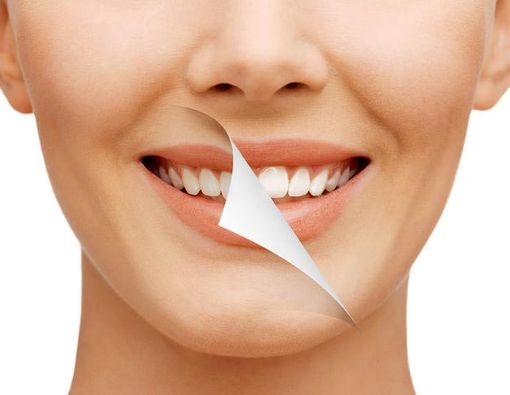 Cara Memutihkan Gigi Tanpa Efek Samping