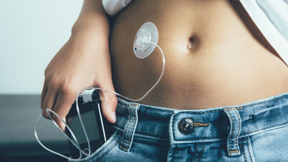 Cara Kerja dan Manfaat Pompa Insulin untuk Penderita Diabetes
