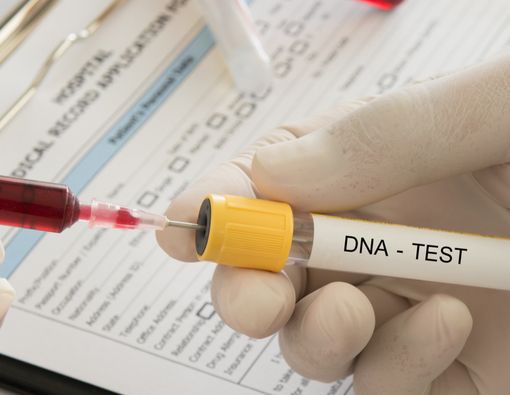 Mengenal Tes DNA, dari Jenis, Cara Kerja, Hingga Hasilnya