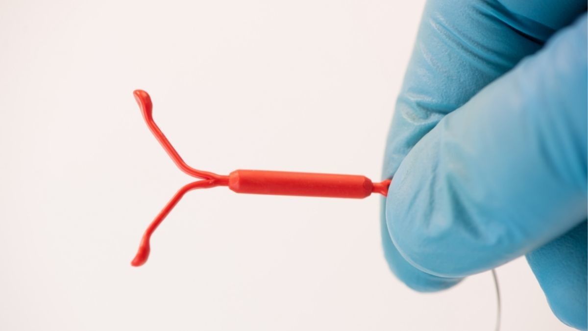 Langkah-langkah Pemasangan Alat Kontrasepsi IUD atau KB Spiral