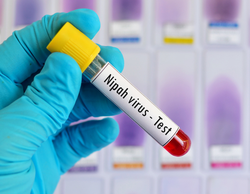 Infeksi Virus Nipah