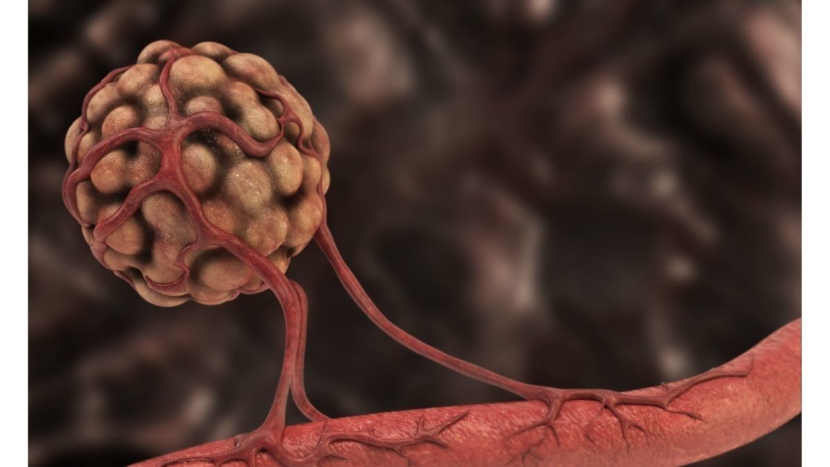 Mengenal Angiogenesis dan Hubungannya dengan Kanker
