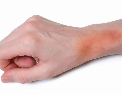 Warna Memar Tunjukkan Kondisi Kesehatan Anda