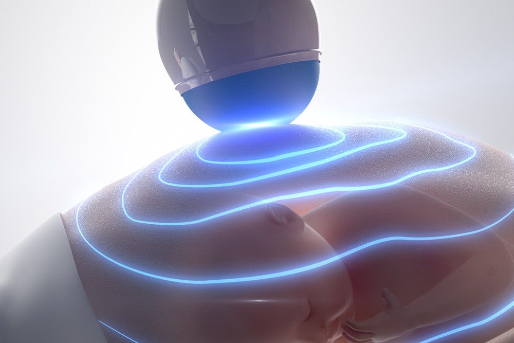 Ini Beda USG 2D, 3D, dan 4D yang Harus Diketahui Ibu Hamil