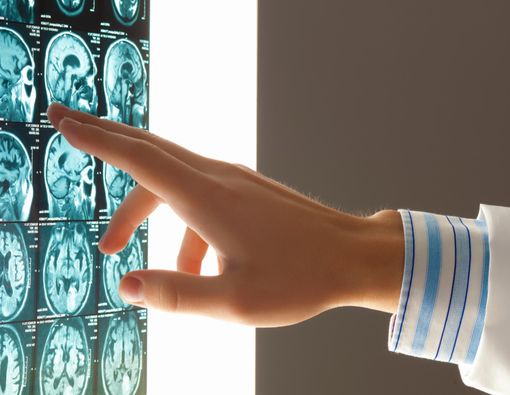 Ketahui Penyebab Penuaan Beserta Gangguannya