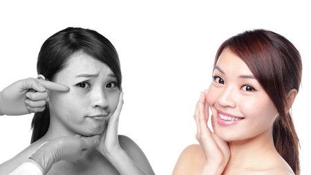 Mengapa Kulit Berkerut, Padahal Masih Muda?