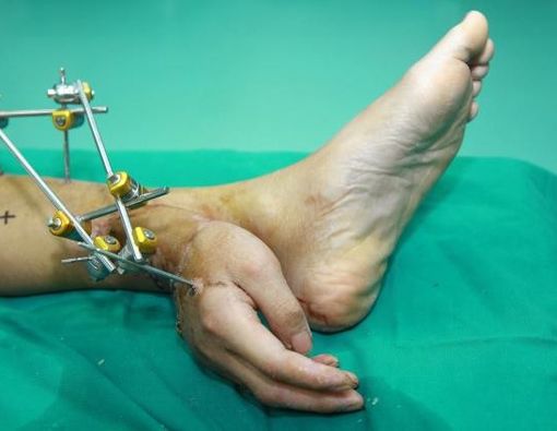 Dokter Menempel Tangan di Kaki Pasien