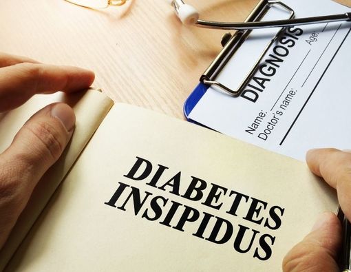Cara Mendiagnosis Diabetes Insipidus