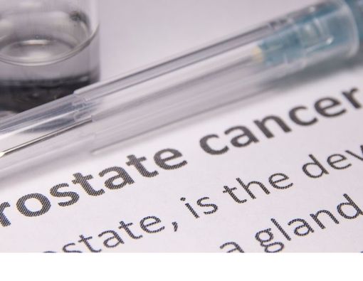 Ejakulasi Secara Rutin, Benarkah Bisa Cegah Kanker Prostat?