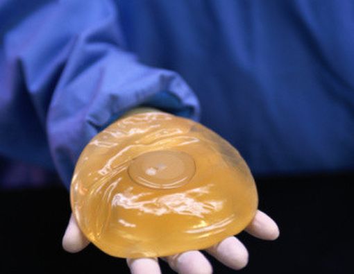 Risiko Radang Payudara Pada Implan Payudara Silikon