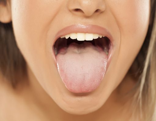 Glossitis, Penyakit yang Bikin Lidah Bengkak dan Meradang