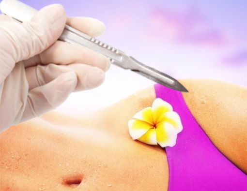 Kembali Perawan dengan Operasi Hymenoplasty