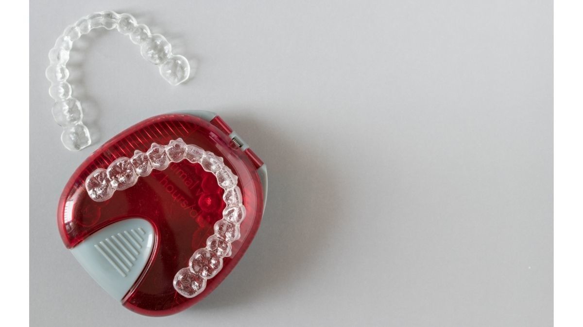 Kapan Anak Boleh Pakai Invisalign?