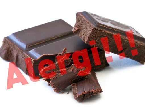 Alergi Cokelat Dapat Mengancam Nyawa Anda