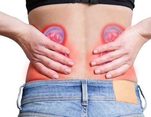 Nyeri Pinggang Akibat Batu Ginjal?