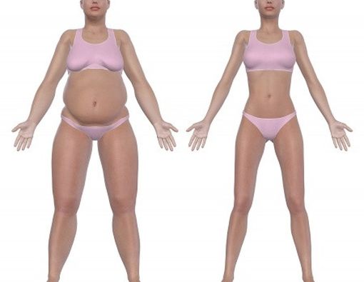 Perut Instan Rata dengan Tummy Tuck