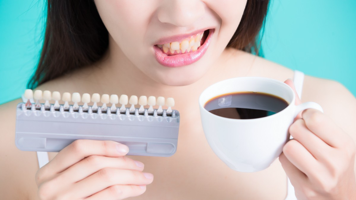 3 Pantangan Setelah Veneer Gigi yang Harus Dihindari