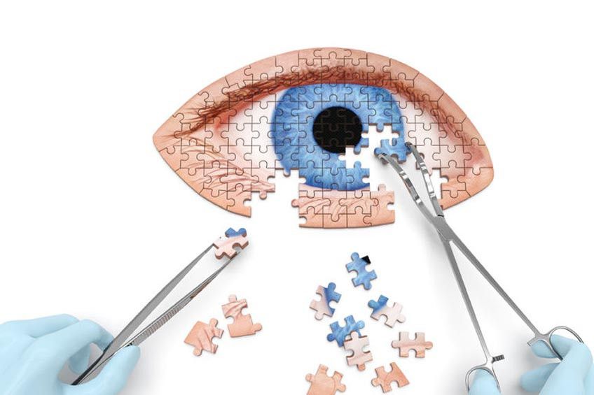 5 Hal untuk Mencegah Anak Terkena Katarak