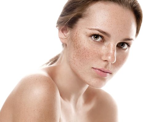 Freckles, Berbahayakah bagi Kesehatan?