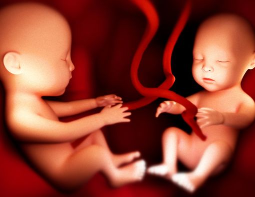 Menyingkap Tanda Kehamilan Kembar yang Jarang Disadari