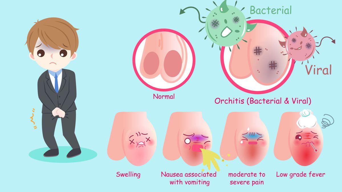 Awas, Infeksi Menular Seksual Bisa Sebabkan Orchitis