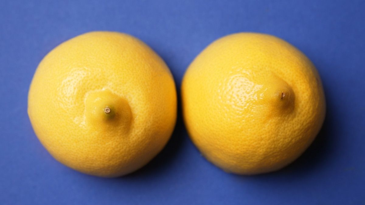 Penyebab Jerawat di Payudara dan Cara Mengatasinya