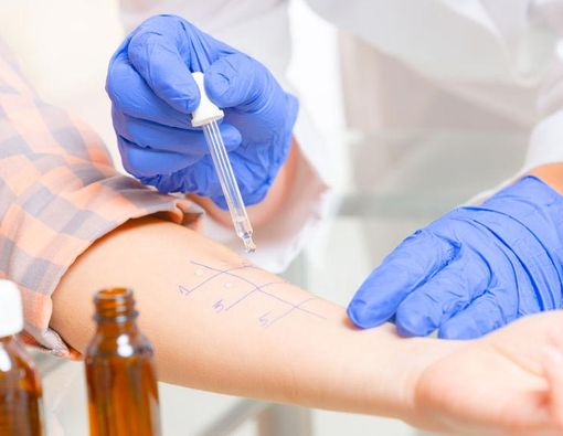 Tes Tusuk Kulit untuk Pastikan Alergi pada Anak