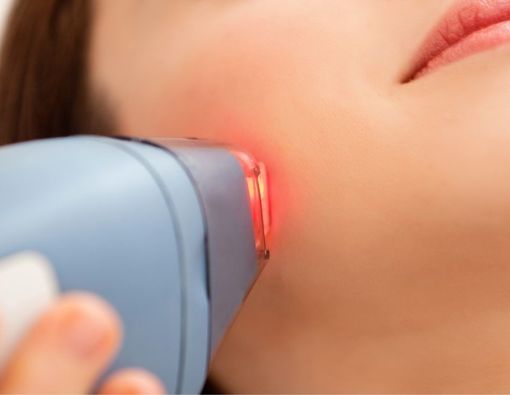 Waspadai Efek Samping Perawatan Setrika Wajah