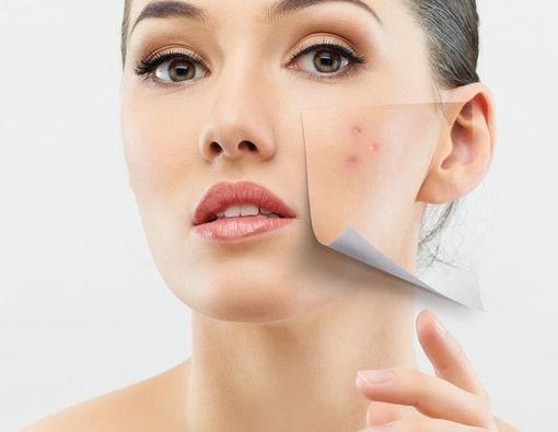 Kulit Anda Sensitif? Mungkin Ini Sebabnya