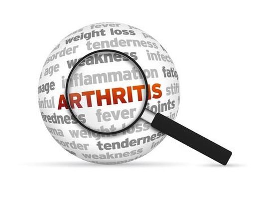 4 Jenis Radang Sendi dan Penanganannya