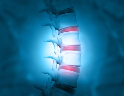 Waspadai 3 Tanda Osteoporosis Ini!