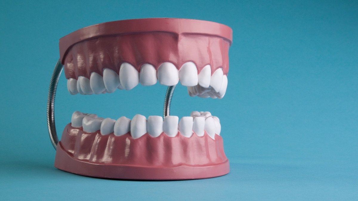 4 Faktor Risiko Terjadinya Microdontia atau Gigi Kecil