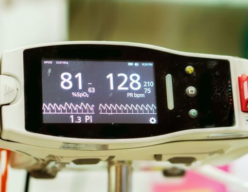 Beda Cek Saturasi Oksigen dengan Oximeter dan Analisis Gas Darah