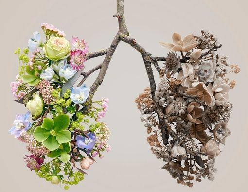 Punya Gejala Mirip, Ini Beda Asma dan Bronkitis