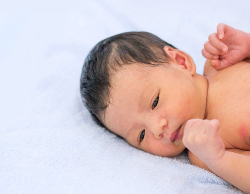 Cara Tepat Mencegah dan Mengatasi Biang Keringat pada Anak 