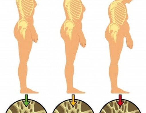 4 Tahap Kehidupan Tulang