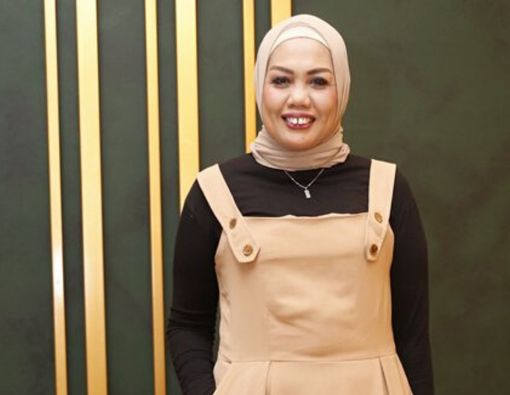 Elly Sugigi Punya Penampilan Baru, Amankah Potong Gigi Menurut Medis?