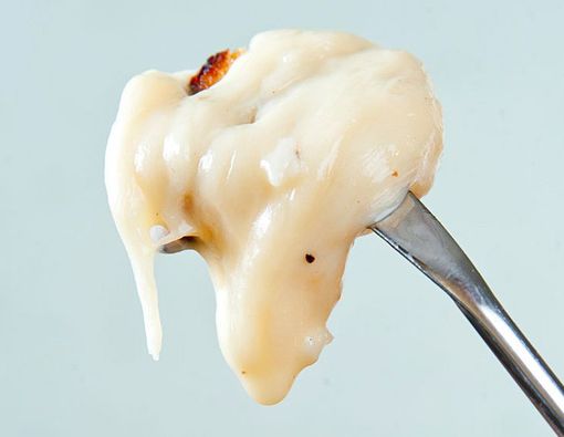 Keputihan Menggumpal Seperti Keju, Berbahayakah?