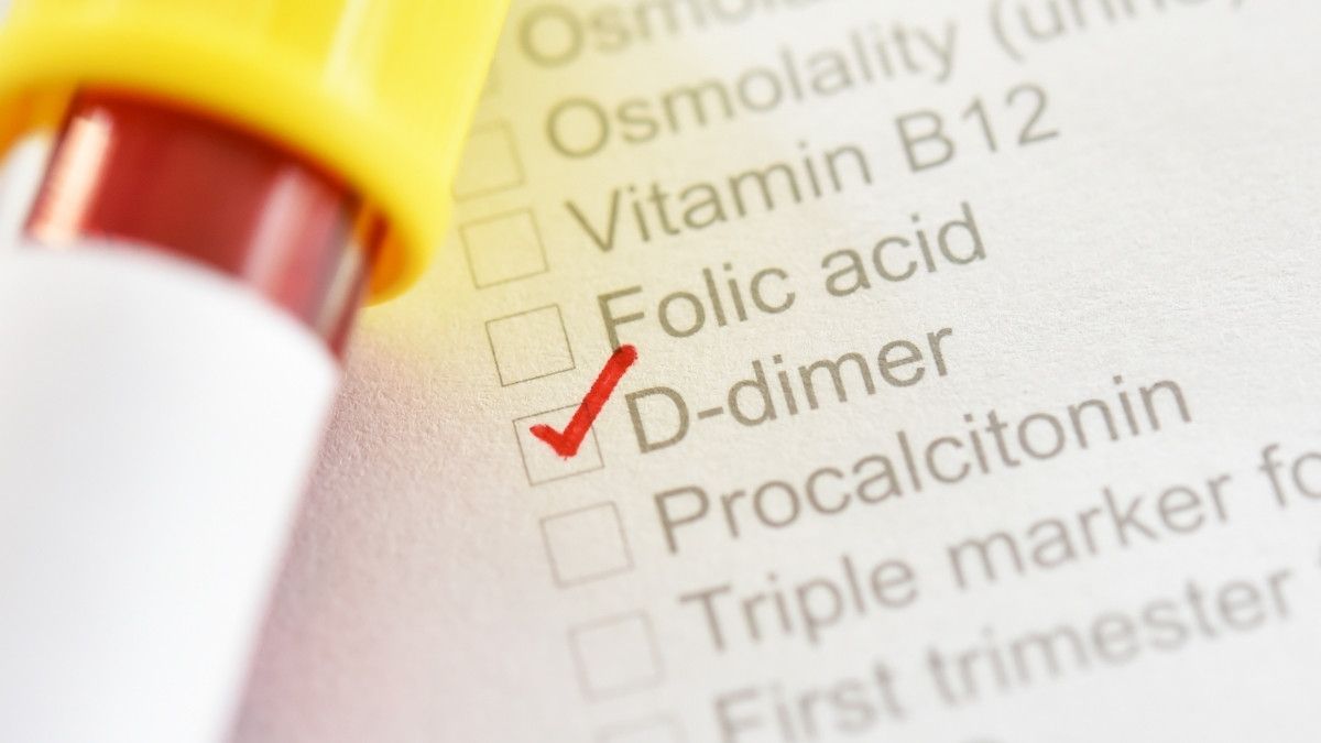 Mengenal DDimer pada Pasien COVID19 KlikDokter