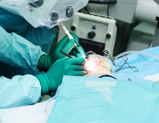 Berbagai Jenis Operasi Tumor Otak dan Efek Sampingnya