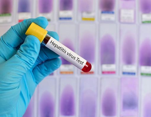 Orang Berprofesi Ini Harus Cek Hepatitis